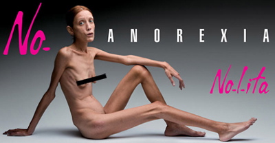 nolia_anorexia (400x208, 37Kb)