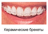 (157x111, 5Kb)