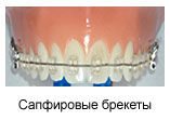  (157x111, 5Kb)