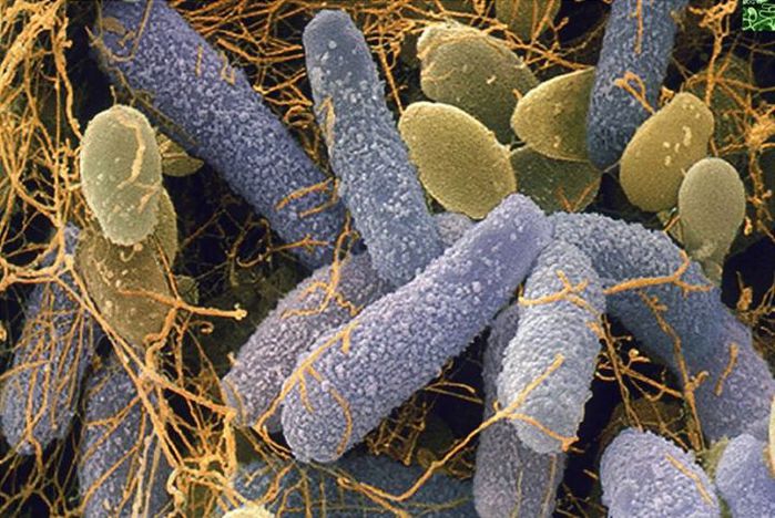 UDG40 acetobacter0 (700x468, 92Kb)