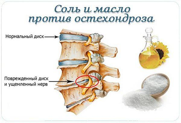 118045075_osteo (600x407, 153Kb)