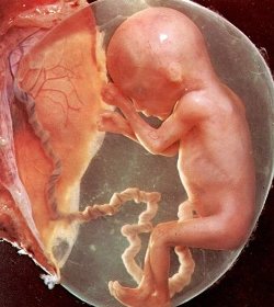 14830274_foetus (250x280, 18Kb)