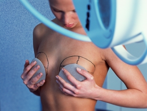 breastimplantsd (500x378, 129Kb)