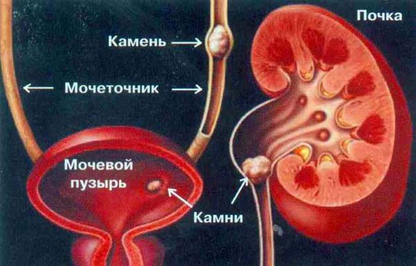 7_OCHISCHENIE_POCHEK (600x384, 36Kb)