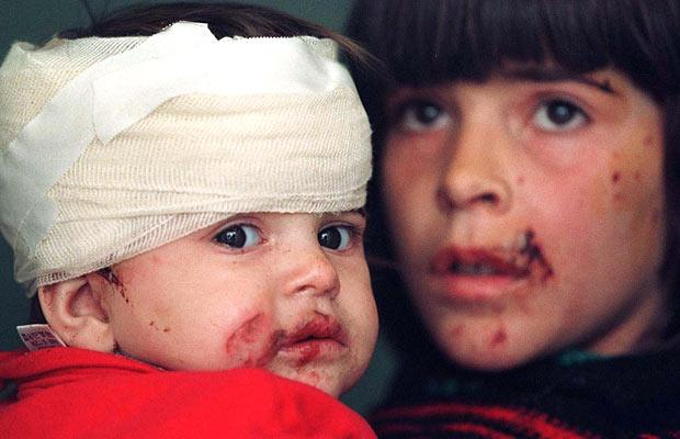 injured-children_1375853i (620x400, 177Kb)