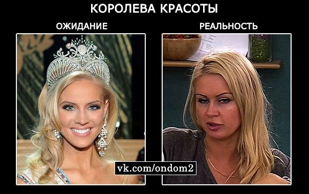 Фото опухшей щиколотки