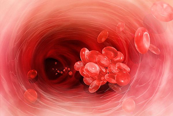 blood-clot1 (600x403, 212Kb)