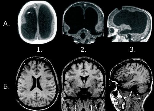no_brain02 (500x359, 40Kb)