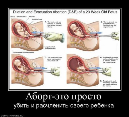 1259172264_1259160s (450x409, 39Kb)