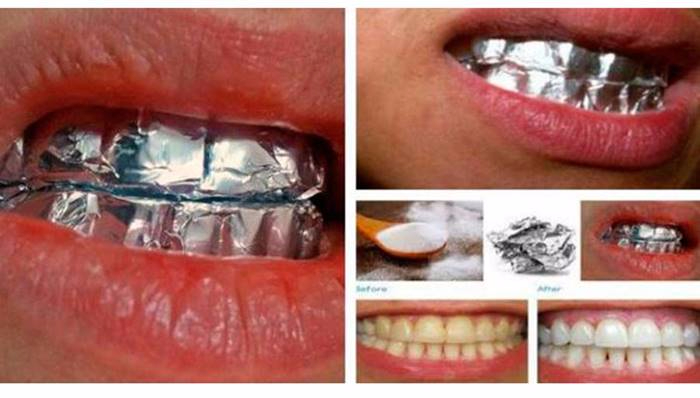 THIS-Is-What-Happens-When-You-Wrap-Your-Teeth-In-Aluminum-Foil-For-1-Hour (700x398, 207Kb)