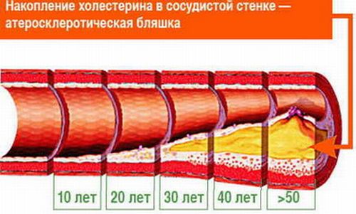 1980311_xolesterin0 (500x301, 34Kb)