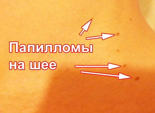 original (1) (500x364, 121Kb)