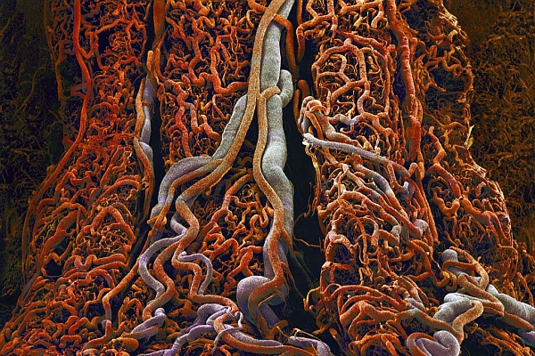small-intestine-blood-vessels-e06073-lw (600x400, 288Kb)
