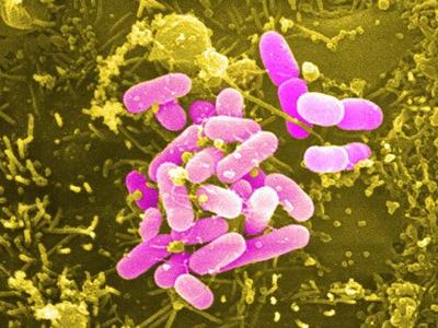 bacterya (400x300, 32Kb)