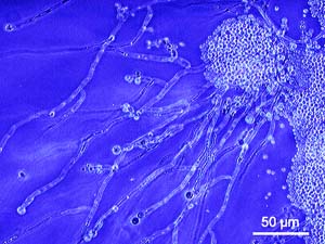 candida albicans (300x225, 20Kb)