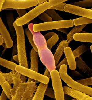 bacillus_anthracis (300x327, 54Kb)
