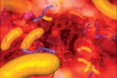 actisorb_fb_1_052005 (400x267, 34Kb)