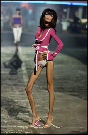 3940075_anorexic2_copy (300x456, 138Kb)