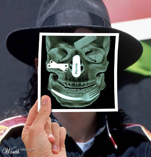 x-ray_12-5 (500x520, 38Kb)