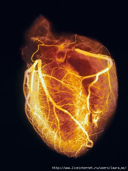 heart-angiogram_986_600x450 (435x580, 97Kb)