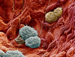 Alveolar_macrophages (300x227, 54Kb)