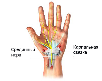 10206 копия (400x320, 66Kb)