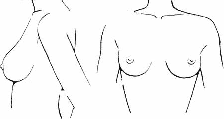 breast04-01 (451x241, 10Kb)