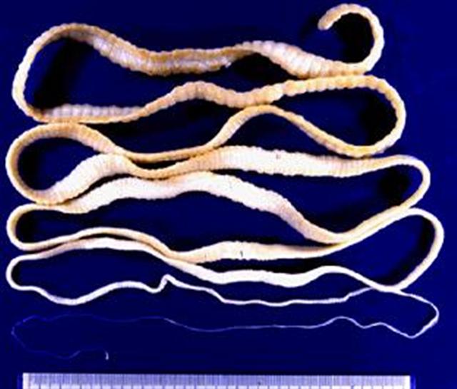 5141577_endoparasitos_taenia_01 (640x546, 42Kb)