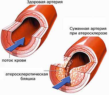 4524271_hondrolon_annotaciya_cena_10112_104 (380x330, 14Kb)