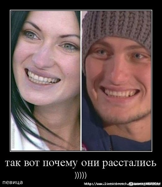 новые зубы венцеслава фото онлайн новые зубы венцеслава фото