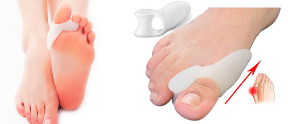 valgus pro    ,         , valgus ,    ,  hallux valgus ,       ,   ,    ,       ,    , hallux valgus 2 ,       ,   ,   ,    , valgus plus  ,  valgus plus  ,     ,   ,    , hallux valgus  , valgus pro    ,
