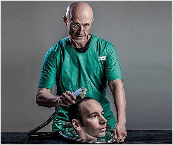 Первая в мире операция по пересадке головы успешно прошла в Китае