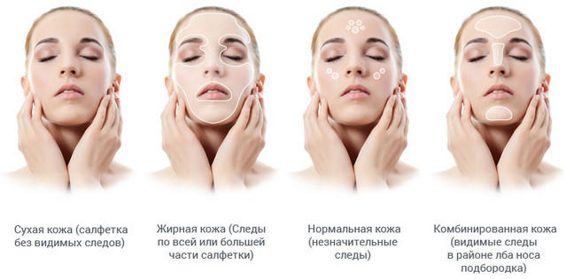5463572_yhod_za_kojei_po_tipam (639x316, 97Kb)