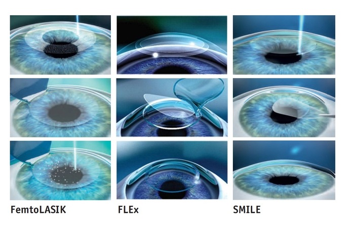 1519846545_28 (700x450, 83Kb)