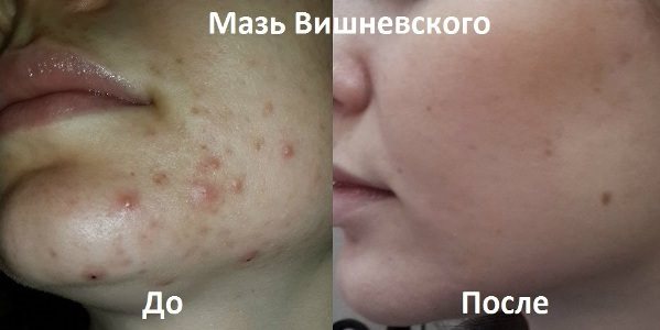 maz_vishnevsogo (599x300, 22Kb)