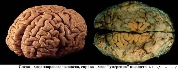 5745884__1_ (700x277, 96Kb)