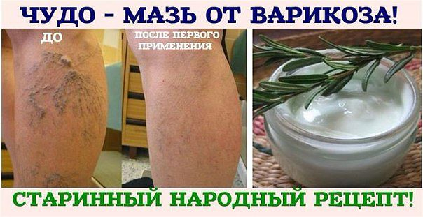 116652032_getImage__12_ (604x311, 185Kb)
