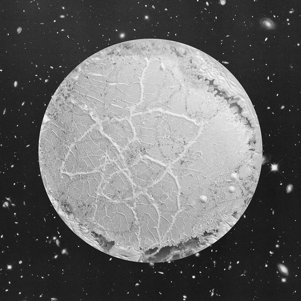 Clostridium Propionicum