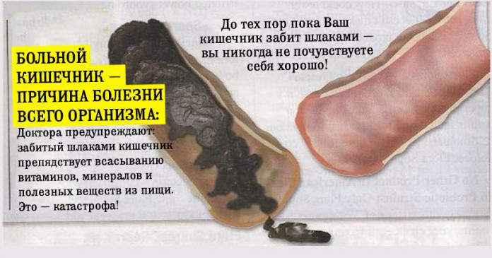 kishka (696x365, 220Kb)