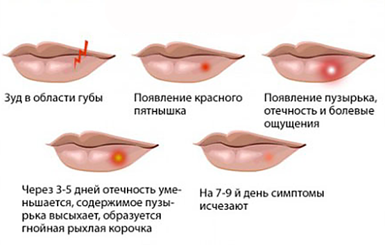 5462122_100__oie_1312383jji7TDU7 (555x354, 138Kb)