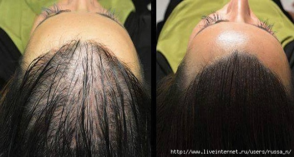 Magic-Recipe-For-Fastest-Hair-Growth-Naturaly-All-Are-Surprised-By-The-Results--- (600x320, 139Kb)