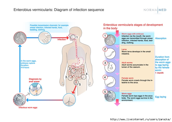 5713211_csm_schema_enterobius_vermicularis_infectionsequences_416314aa98 (700x497, 170Kb)