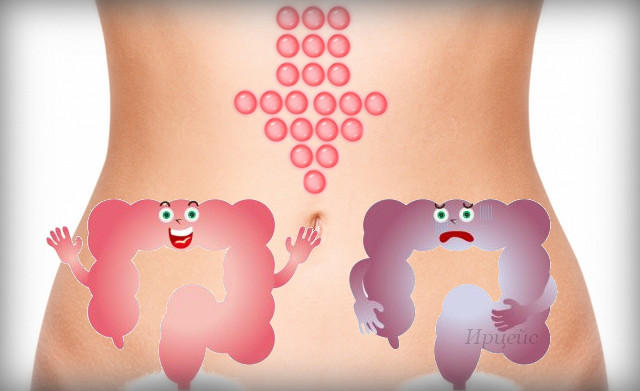 3720816_gidrokolonoterapiya_mifi (640x391, 29Kb)