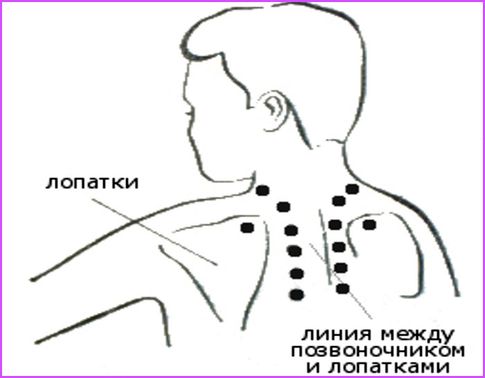 Банки при болях в спине. Точки при остеохондрозе грудного отдела позвоночника. Точечный массаж спины схема. Массаж акупунктурный точки спины. Точки акупунктуры при остеохондрозе шейного отдела позвоночника.