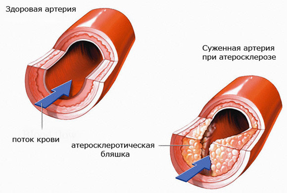 4003916_20190526_072657_1_ (580x391, 58Kb)