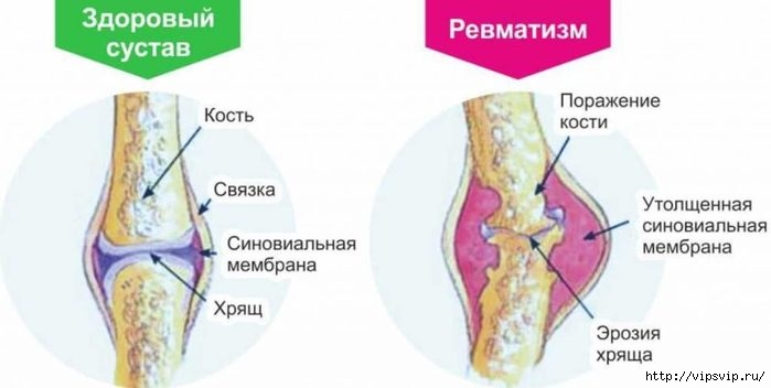 5745884_systavi_bolnie (700x352, 85Kb)
