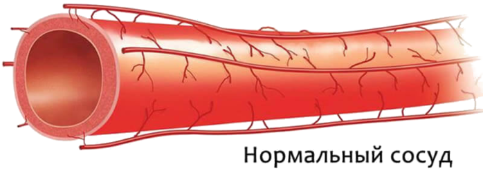 Укрепление стенок сосудов. Сосуд в разрезе. Сосуды сосудов. Кровеносные сосуды рисунок.