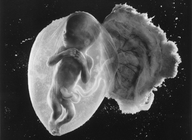 Эмбрион человека _18 недель (640x468, 69Kb)