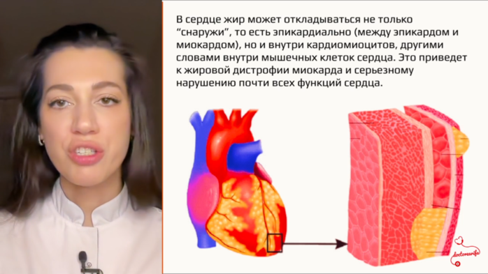 Снимок экрана (535) (700x393, 289Kb)