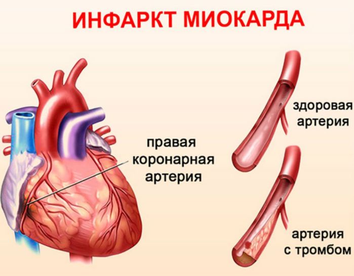 1 (700x546, 44Kb)